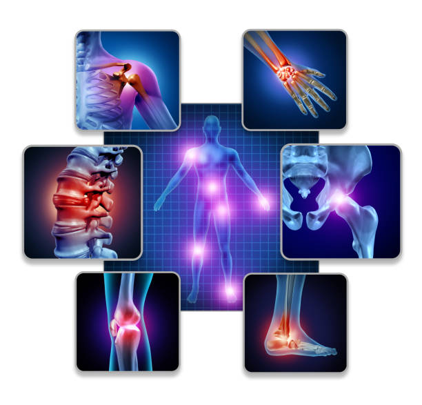Reactive arthritis, trivandrum