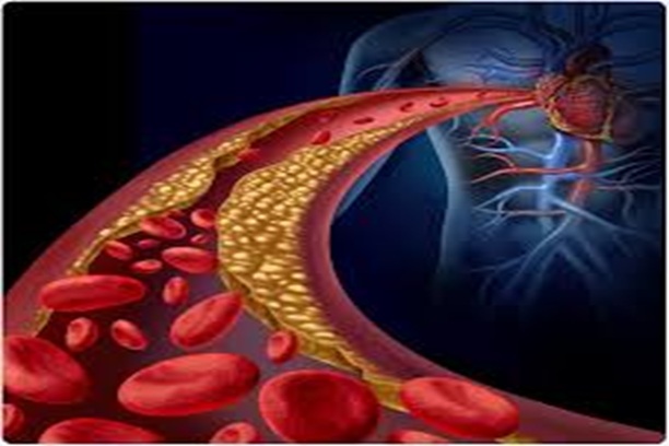 Clotting Factor Therapy Tvm