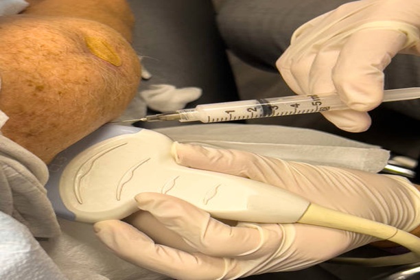 Corticosteroid Therapy Tvm