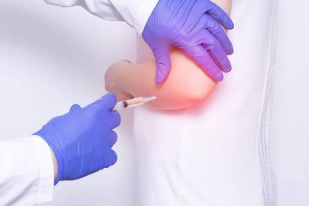 Platelet-Rich Plasma tvm