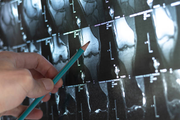 Bone Density Screening Tvm