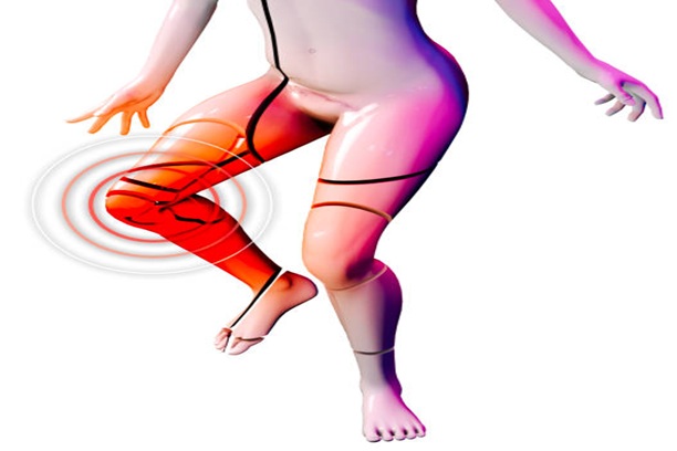 Bisphosphonate Therapy Tvm