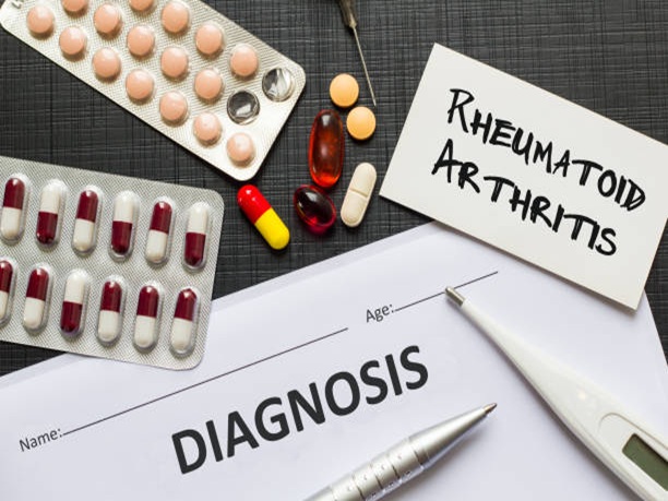 Disease Modifying Anti-Rheumatic Tvm