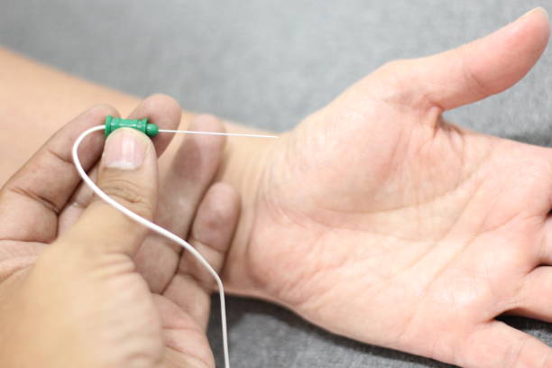 Sympathetic Nerve Blocks Tvm