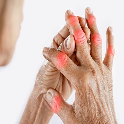 Rheumatoid arthritis, trivandrum