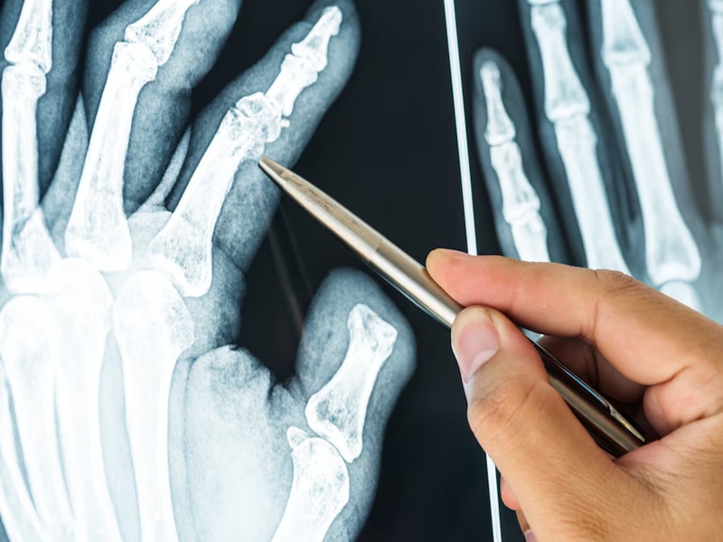 Personalized Treatment Options Tvm