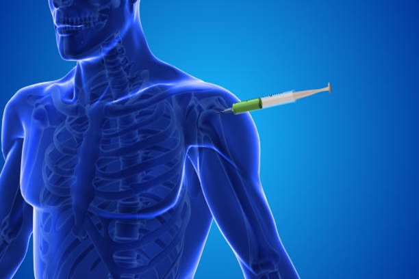 Platelet-Rich Plasma (PRP)  Tvm
