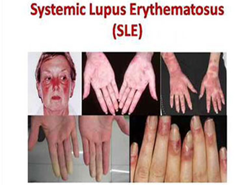 Personalized Treatment Strategies Tvm